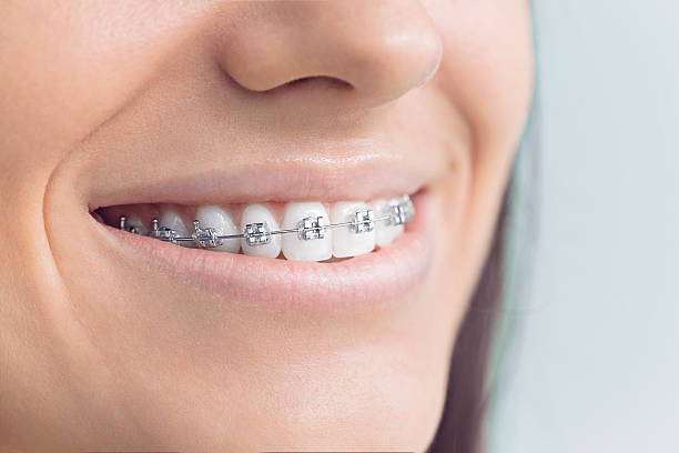 Trusted Matteson, IL  Holistic Dental Services Experts